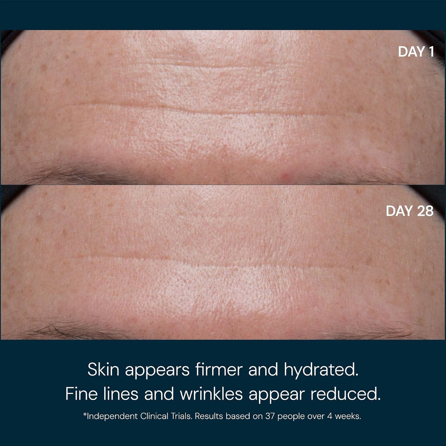 Radiant Glow Anti-Wrinkle Cream